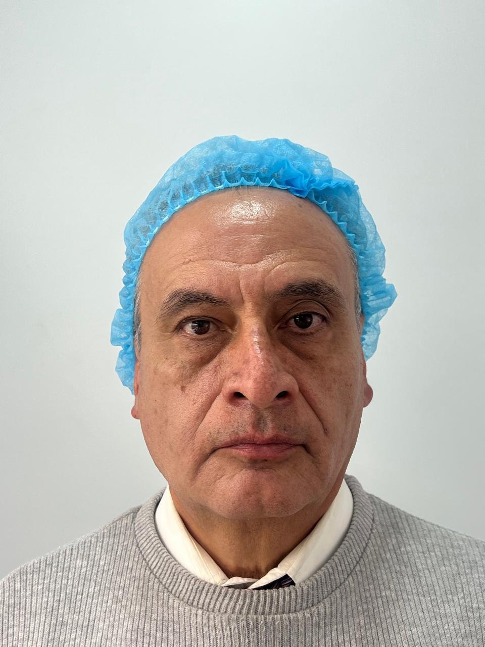 Después del tratamiento Pico Láser