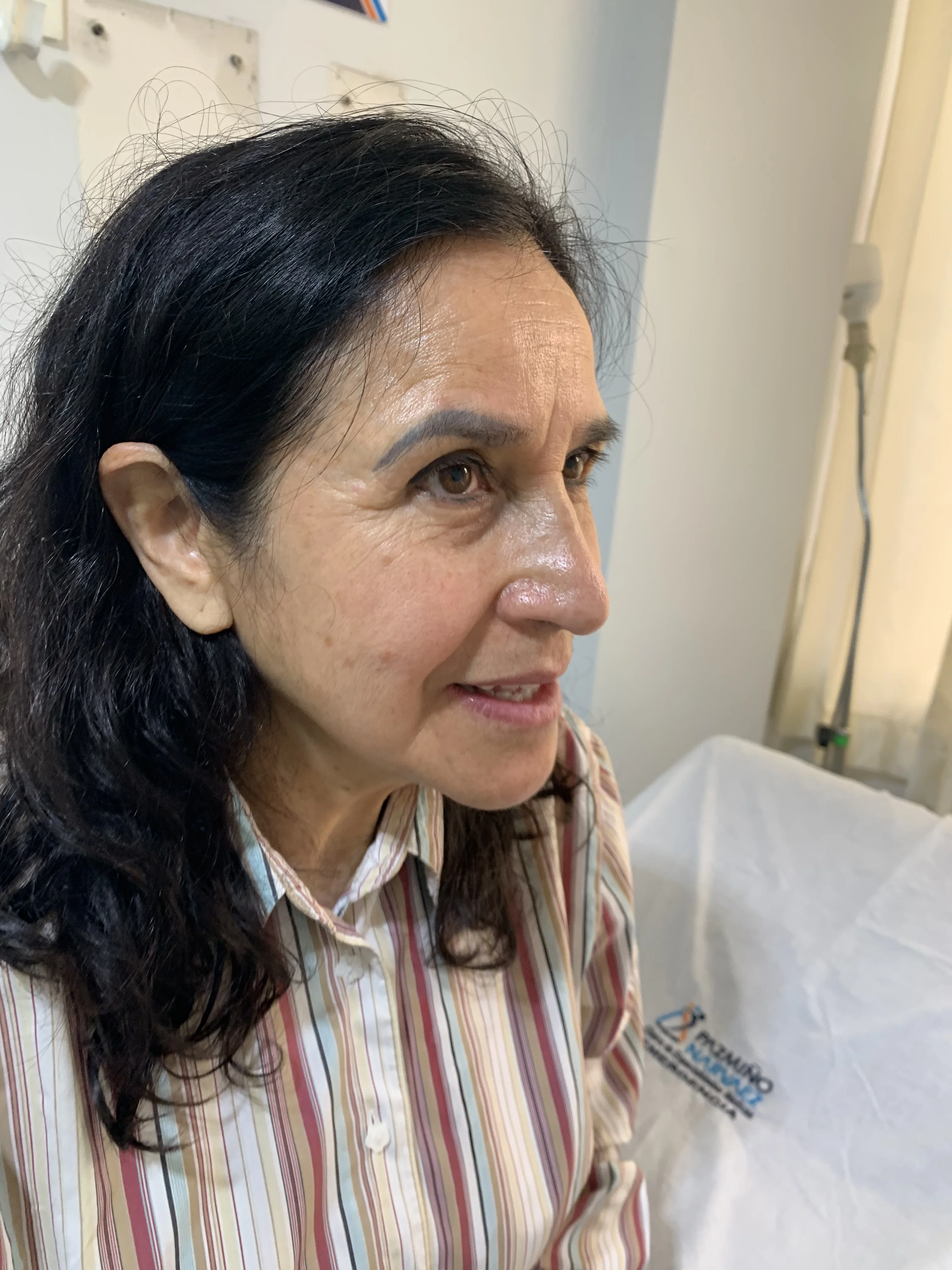 Antes del tratamiento Skin Booster